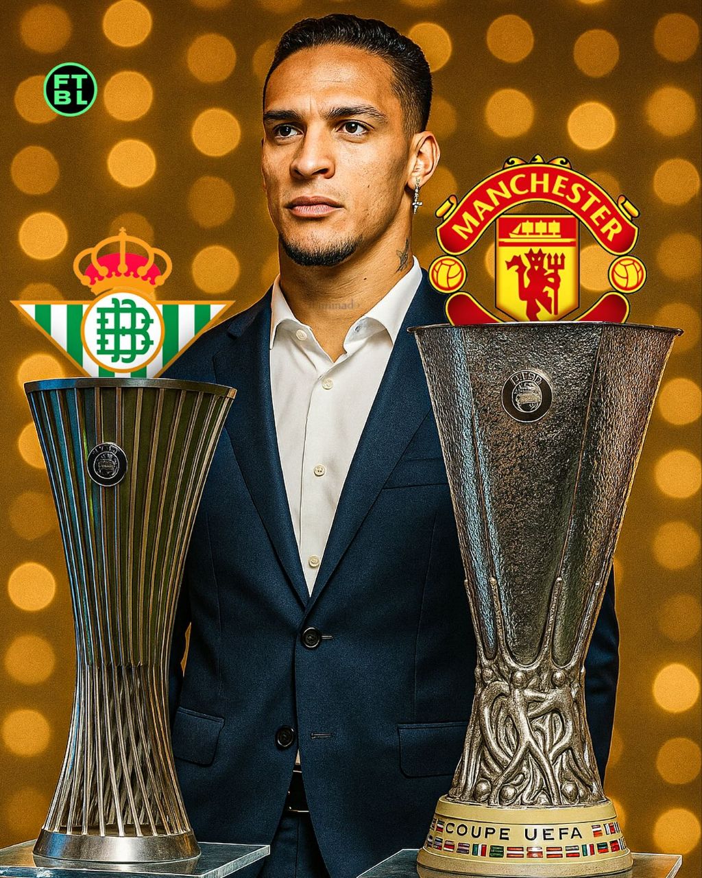 انتونی